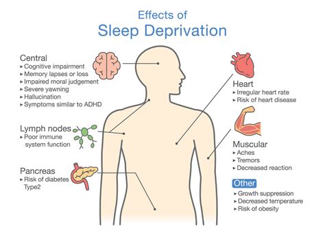 sleep deprivation what impact is it having on productivity pomodoneapp
