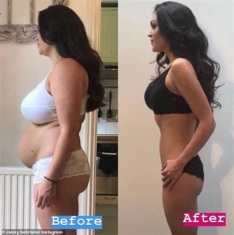 Casey Batchelor Continues To Flaunt Her Four Stone Weight
