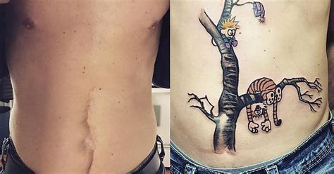 Tattoos That Cover Scars Album On Imgur