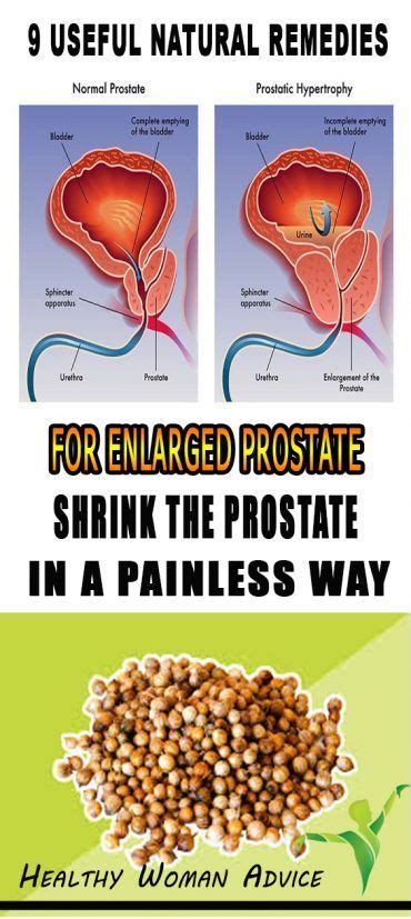 9 Useful Natural Remedies For Enlarged Prostate Shrink The Prostate In