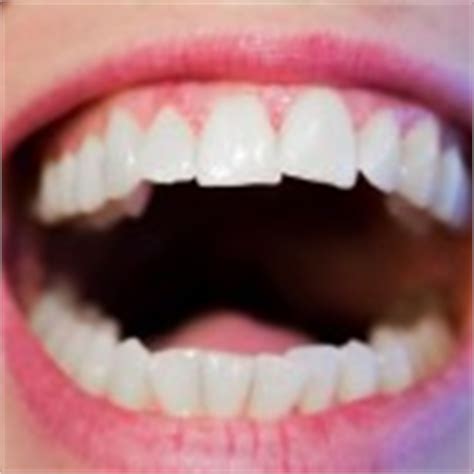 zwart tandvlees oorzaken van zwarte vlekken op tandvlees mens en gezondheid aandoeningen