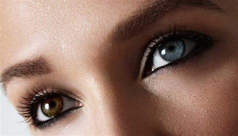 twee verschillende kleuren ogen gezondheidsnet
