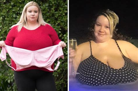 Plastic Surgery Mum Desperate For Breast Reduction After