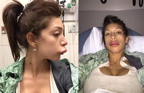 what happened to farrah abraham s lips teen mom porn star
