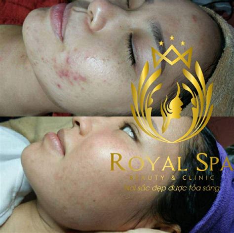 royal spa beauty clinic