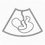 Womb Baby Outline Ultrasound Fetus Drawing Icon Pregnancy Line Getdrawings sketch template