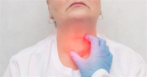 goiter enlarged thyroid types symptoms   treatment