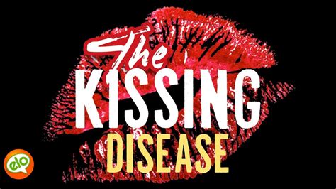 kissing disease mononucleosis   youtube