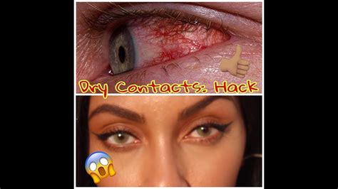 dry contact lens hack youtube