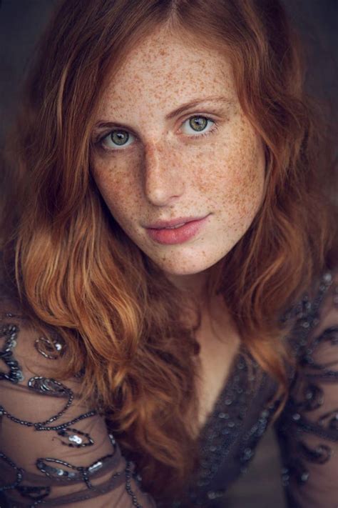 Redhead Freckles R Welovefreckles