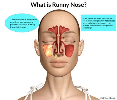 runny nose  rhinorrhea   allergy   nasal congestion stuffiness