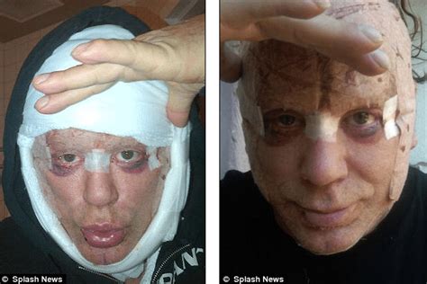 here s mickey rourke with new plastic surgery still a hawt bixch…