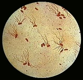 salmonella typhi diagnostic