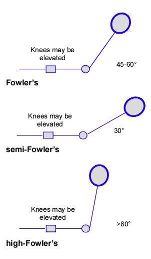 high fowlers position   degrees semi fowlers position