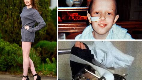 Teenage Bone Cancer Survivor Wears Heels For First Time After Her Leg