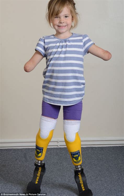 five year old girl who lost her limbs to meningitis runs for the first