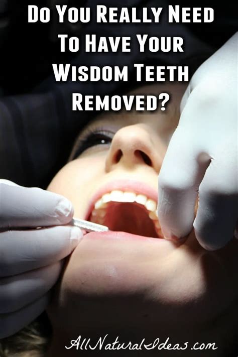 wisdom teeth surgery is it really necessary all natural ideas