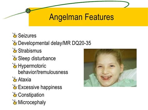 Angelman Syndrome Doctor