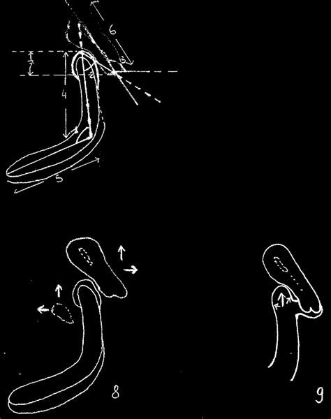 Mri Second Session Angles And Lengths 1 Angle 110º 2 Angle 50º