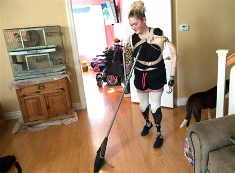 a quadruple amputee takes steps toward independence