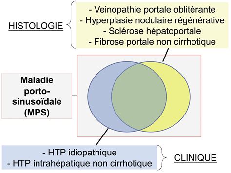 Hyperplasie Nodulaire Regenerative Hnr Diffuse – Fmc Hge