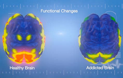 Understanding Addiction Reward And Pleasure In The Brain