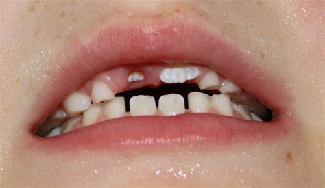 teeth scottandhisthoughts