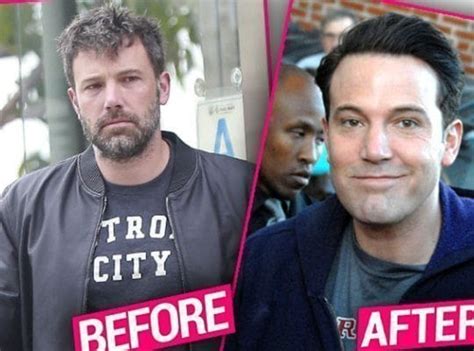 Bad Plastic Surgery Rumors 5 Male Celebrities Men S