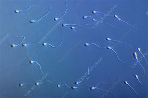 human sperm stock image p624 0123 science photo library