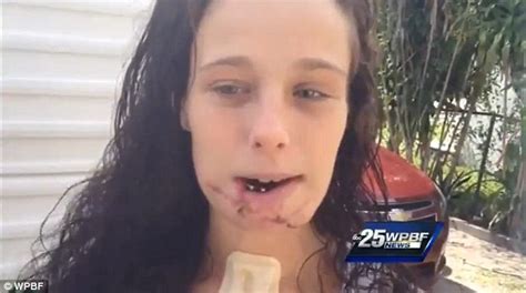 Florida Pizza Delivery Woman Shot In Face By Halloween Mugger Leaves