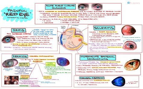 painful red eye differential diagnosis acute grepmed