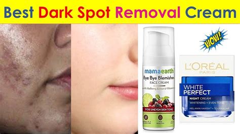 dark spot removal cream  india   price anti