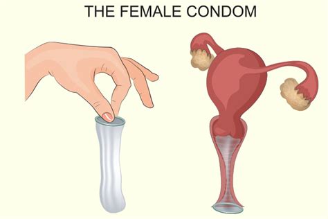 8 effective non hormonal birth control methods with advantages