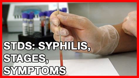 stds syphilis stages symptoms treatment and prevention youtube