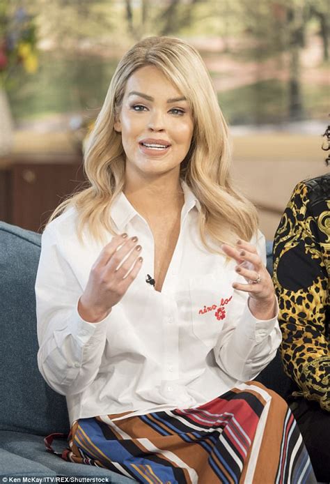 Katie Piper Couldnt Make Expressions After Acid Attack Daily Mail Online