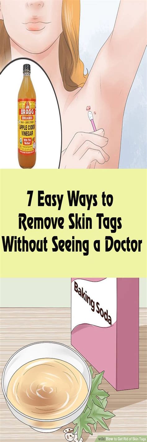 can you use duct tape to get rid of skin tags howtormeov