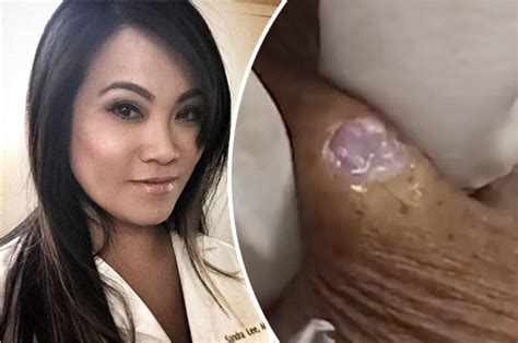 Youtube Star Dr Pimple Popper Releases Best Of 2016 Vid