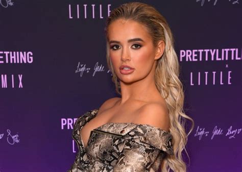 Molly Mae Hague Feels Sick Seeing Old Photos Of Her Lip Fillers