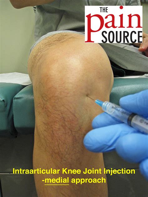 intraarticular knee joint injection technique  tips  pain source  learning