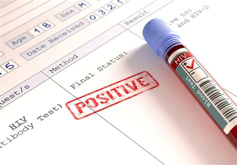 the meaning of a positive hiv test