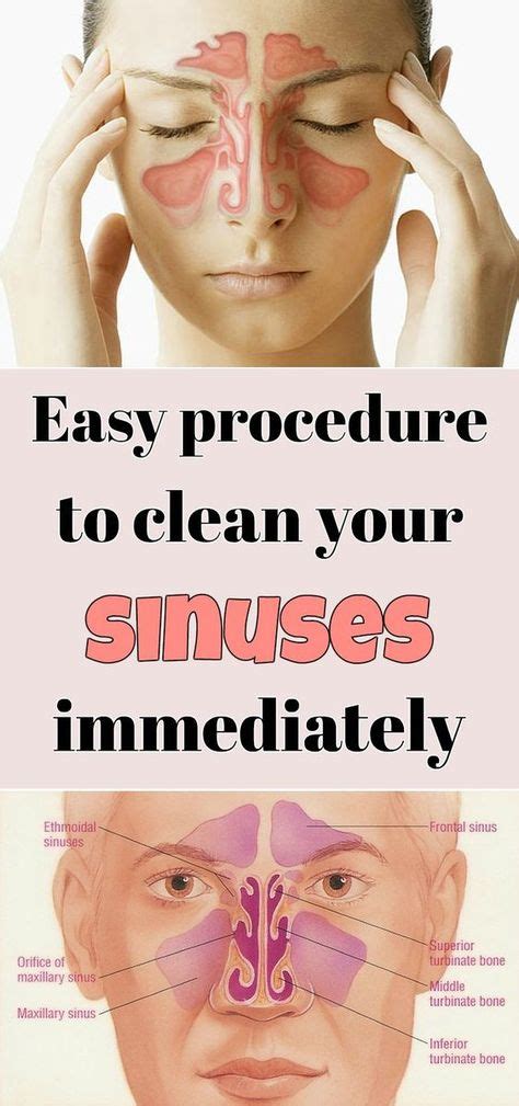 easy procedure  clean  sinuses immediately  images