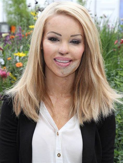 I Was Sure I D Never Be Loved Katie Piper On Her Struggle To Find