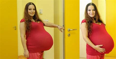 23 Year Old Woman Miraculously Gives Birth To The First Ever