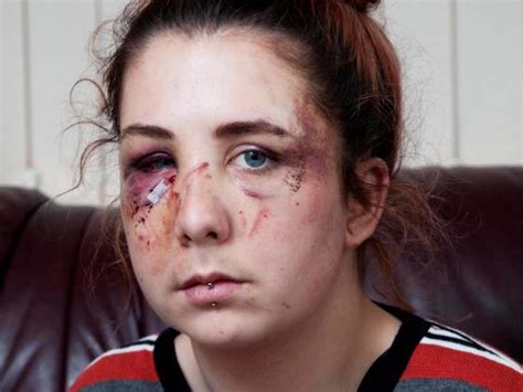 woman only stopped beating up autistic teenager after