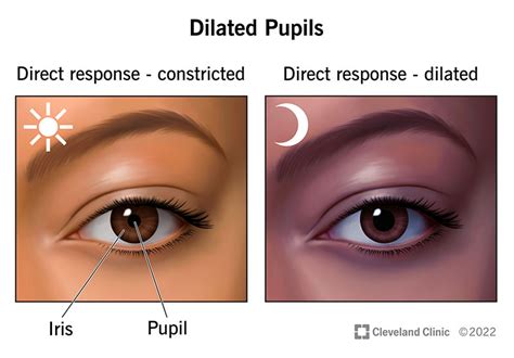dilated pupils mydriasis