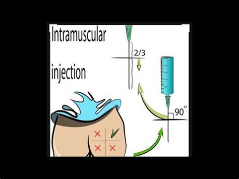 give intramuscular injection  gluteal region injection medicos medical youtube
