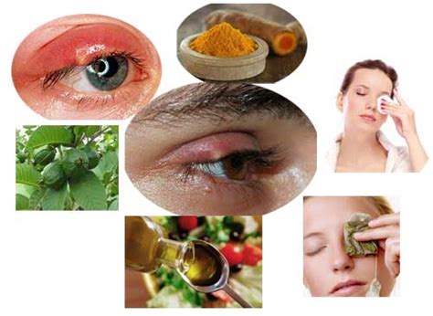 6 home remedies for stye on upper eyelid home health