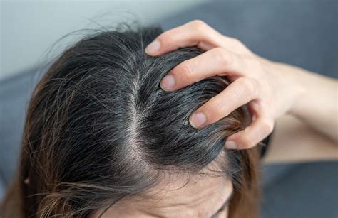 itchy scalp  treatment  prevention