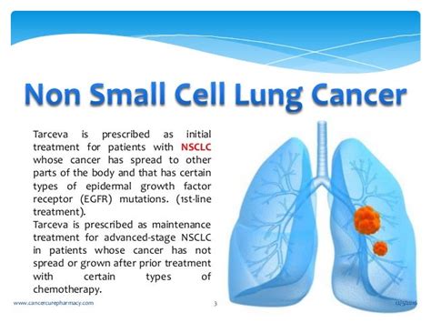 cure   small cell lung cancer cancerwalls