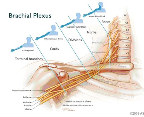 anterior  lateral division   brachial plexus brachial human